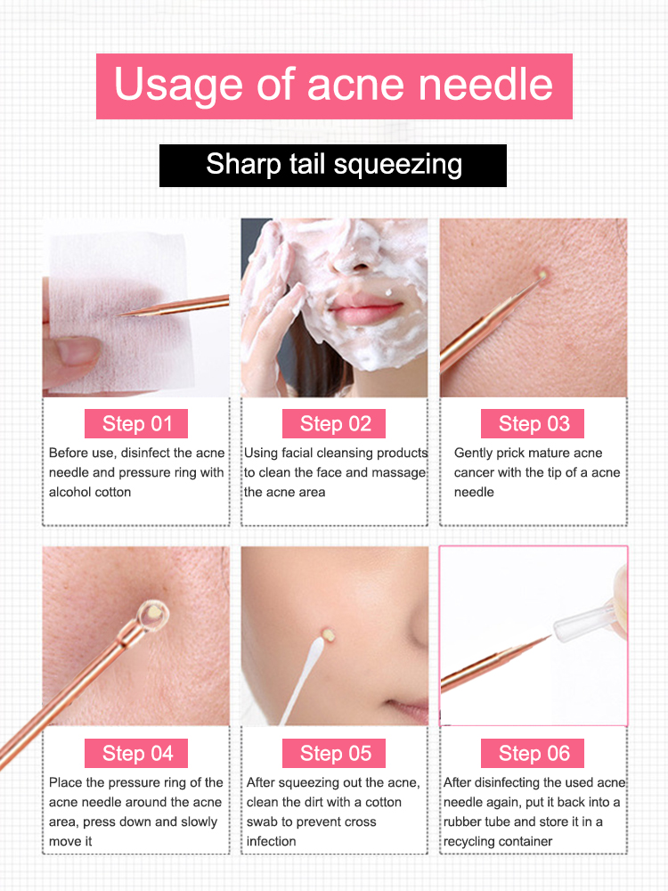 Removedor de cravo espinha com - Luxury Skincare Acne avaliação e preço