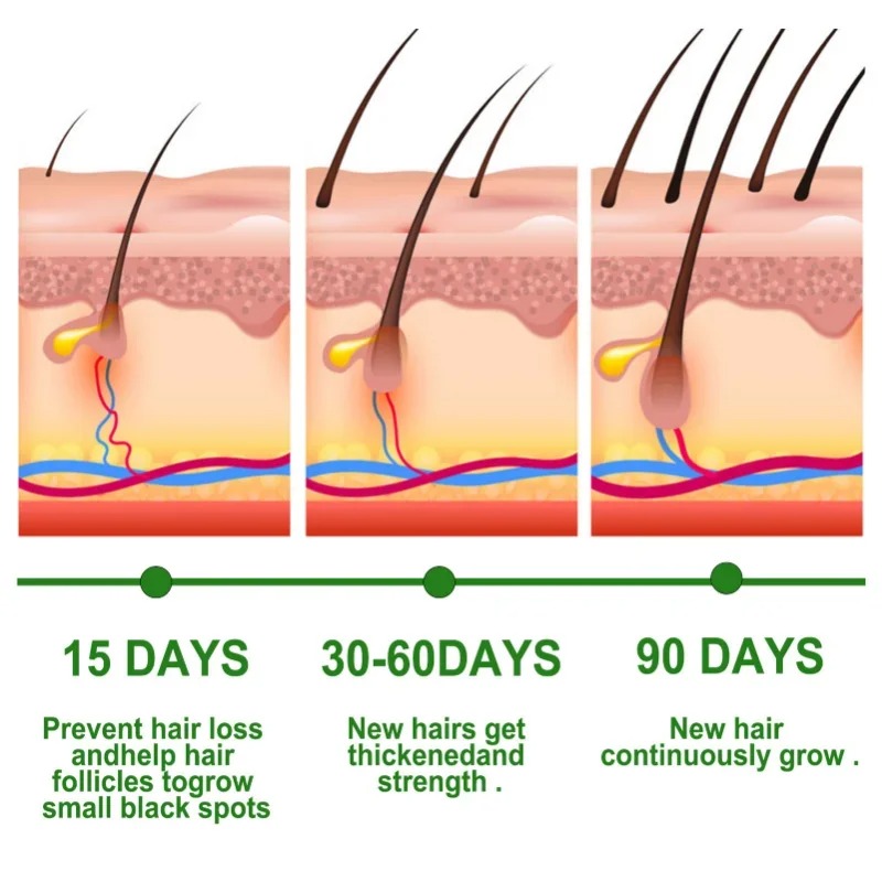 Soro de crescimento capilar, c - Epidermal Growth Factor avaliação e preço