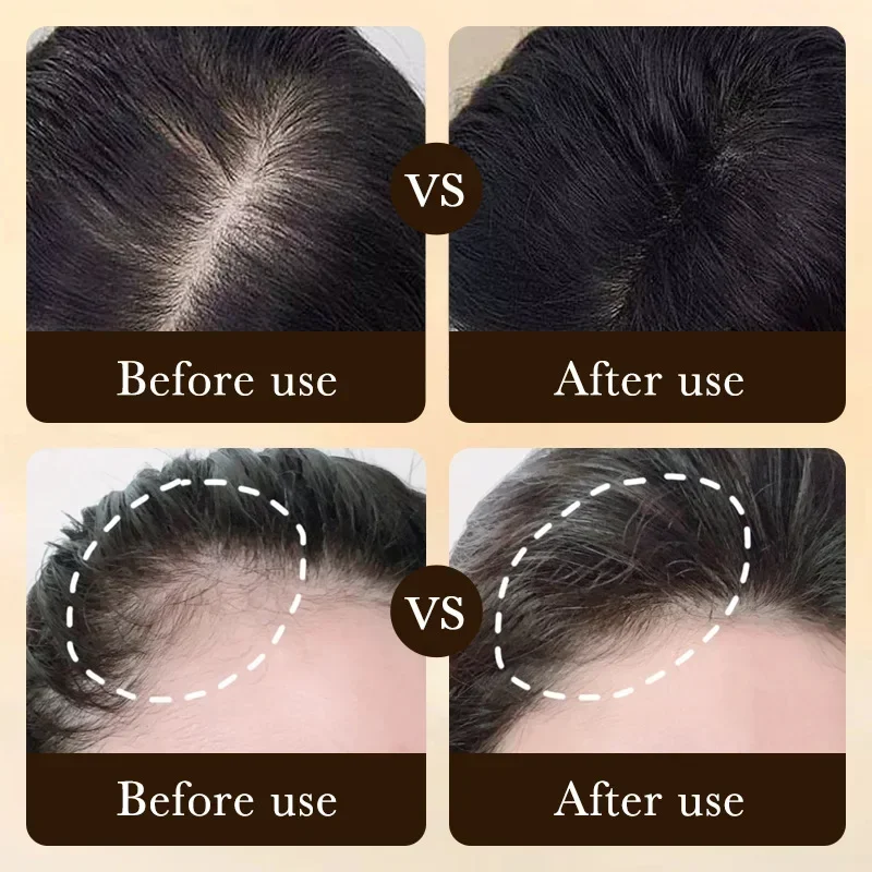 Óleo de Crescimento Rápido de  - Epidermal Growth Factor avaliação e preço
