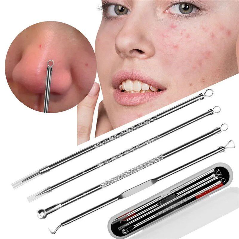 Kit de Ferramentas para Remoçã - Luxury Skincare Acne avaliação e preço