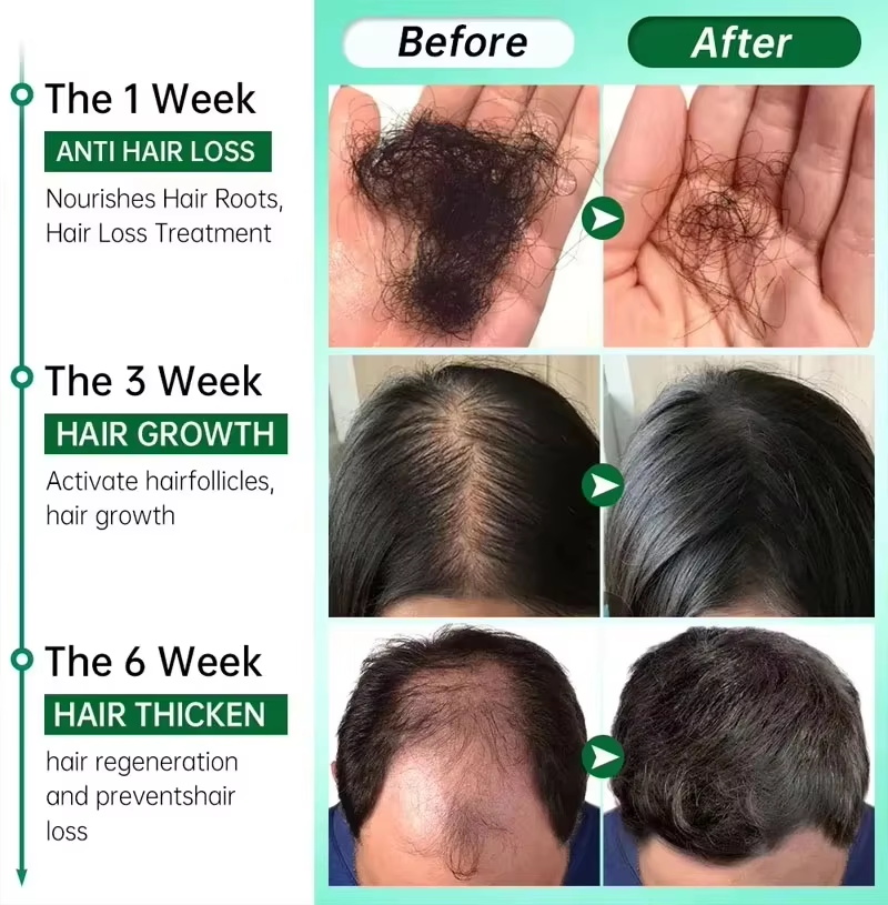 Sérum para Crescimento Capilar - Epidermal Growth Factor avaliação e preço
