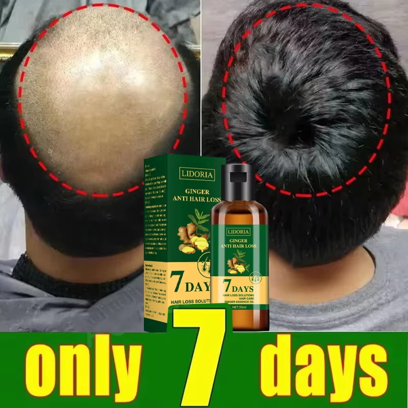 Sérum para Crescimento Capilar - Epidermal Growth Factor avaliação e preço
