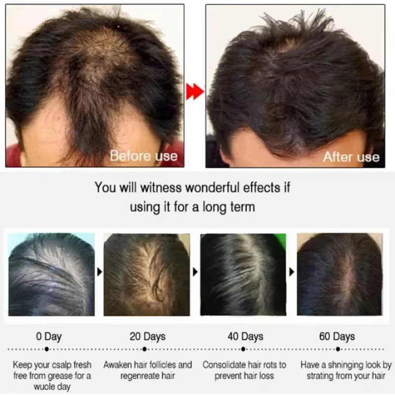 Sérum para Crescimento Capilar - Epidermal Growth Factor avaliação e preço